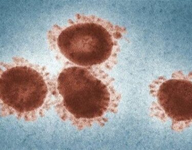 Virus kya hai aur kaise failta hai.